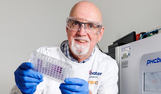 a man in a white coat, glue gloves and glasses holds up a small tray of purple dots